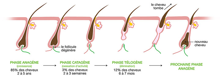 Calvitie Humaine Ou Perte De Cheveux - Un Médecin Portant Des